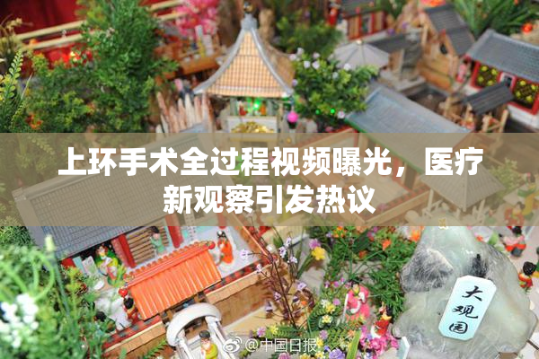 上环手术全过程视频曝光，医疗新观察引发热议