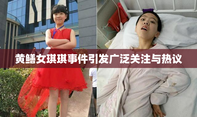黄鳝女琪琪事件引发广泛关注与热议