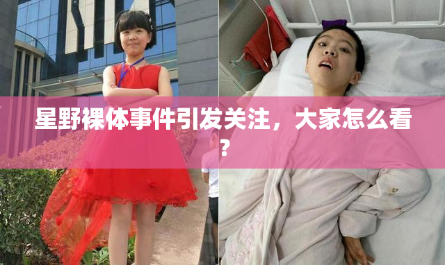 星野裸体事件引发关注，大家怎么看？