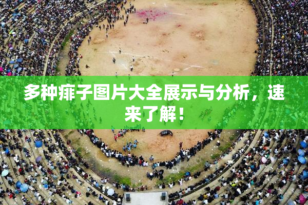 多种痱子图片大全展示与分析，速来了解！