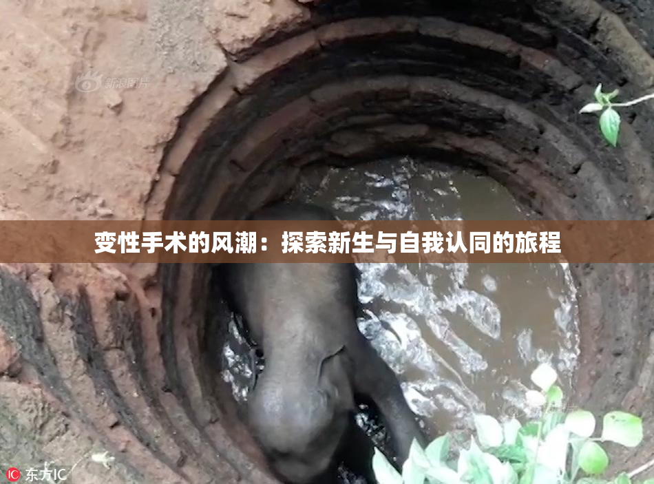 变性手术的风潮：探索新生与自我认同的旅程