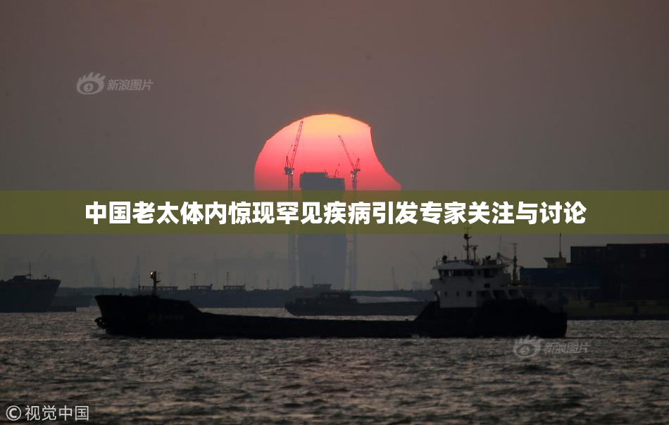 中国老太体内惊现罕见疾病引发专家关注与讨论