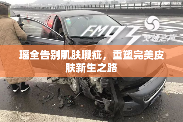 瑶全告别肌肤瑕疵，重塑完美皮肤新生之路
