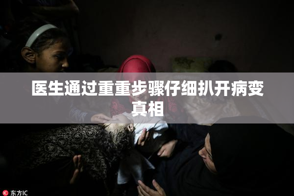 医生通过重重步骤仔细扒开病变真相