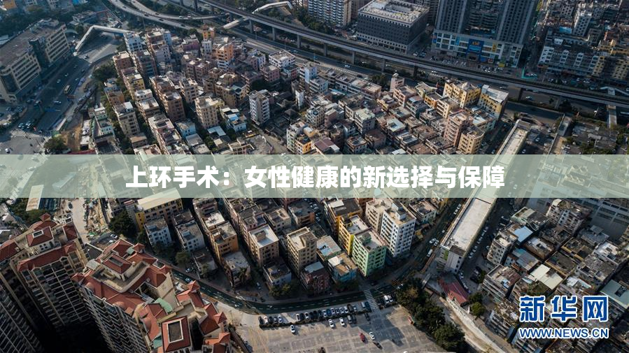 上环手术：女性健康的新选择与保障