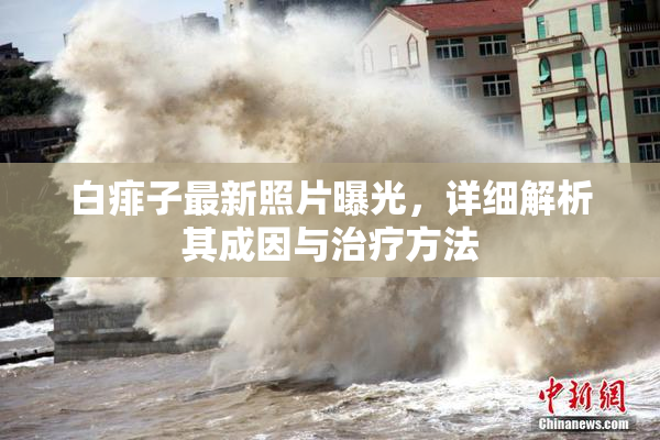 白痱子最新照片曝光，详细解析其成因与治疗方法