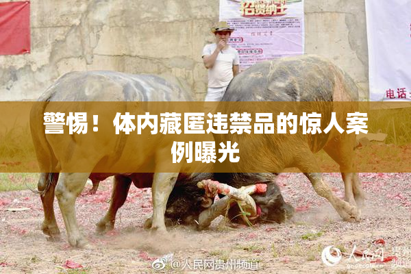 警惕！体内藏匿违禁品的惊人案例曝光