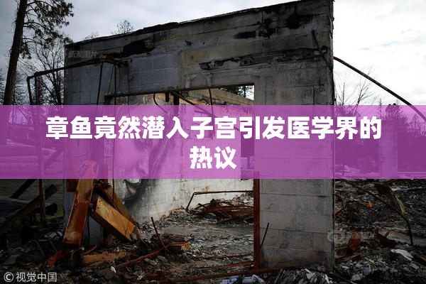 章鱼竟然潜入子宫引发医学界的热议