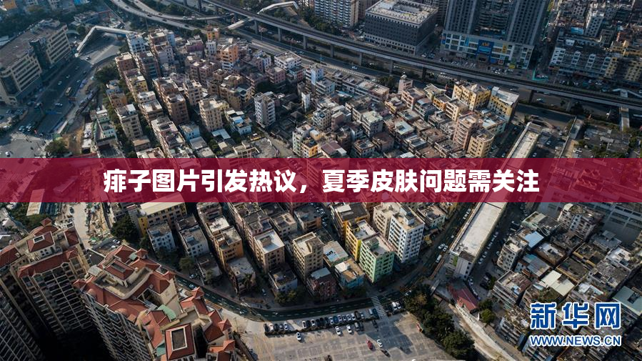 痱子图片引发热议，夏季皮肤问题需关注