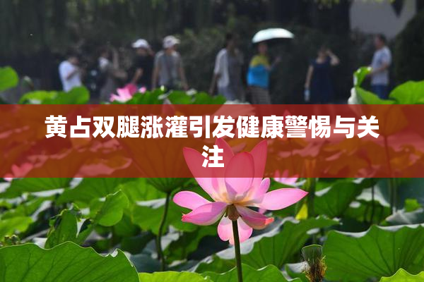 黄占双腿涨灌引发健康警惕与关注
