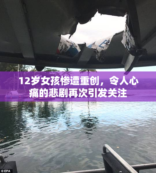 12岁女孩惨遭重创，令人心痛的悲剧再次引发关注
